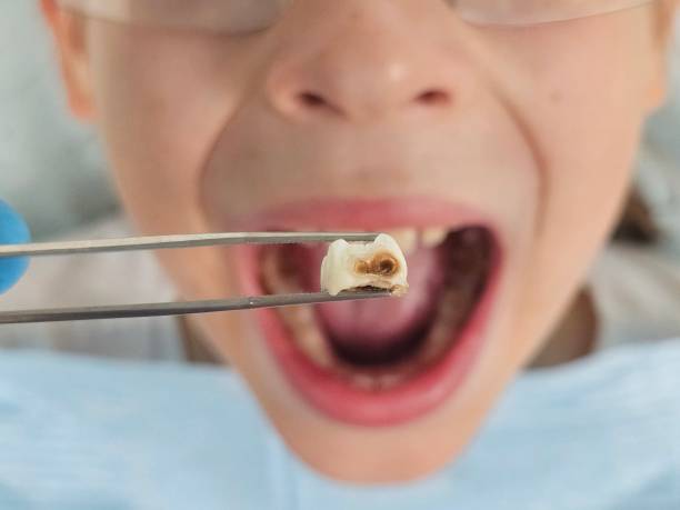 Best Emergency Gum Pain Relief  in Desloge, MO